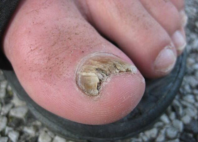 The result of abandonment