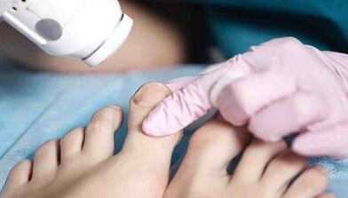 Hardware mushroom treatment on the legs