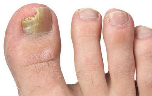 Various forms of mushroom