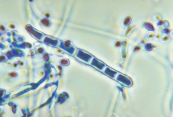 Trichophyton rubrum mushroom under the microscope